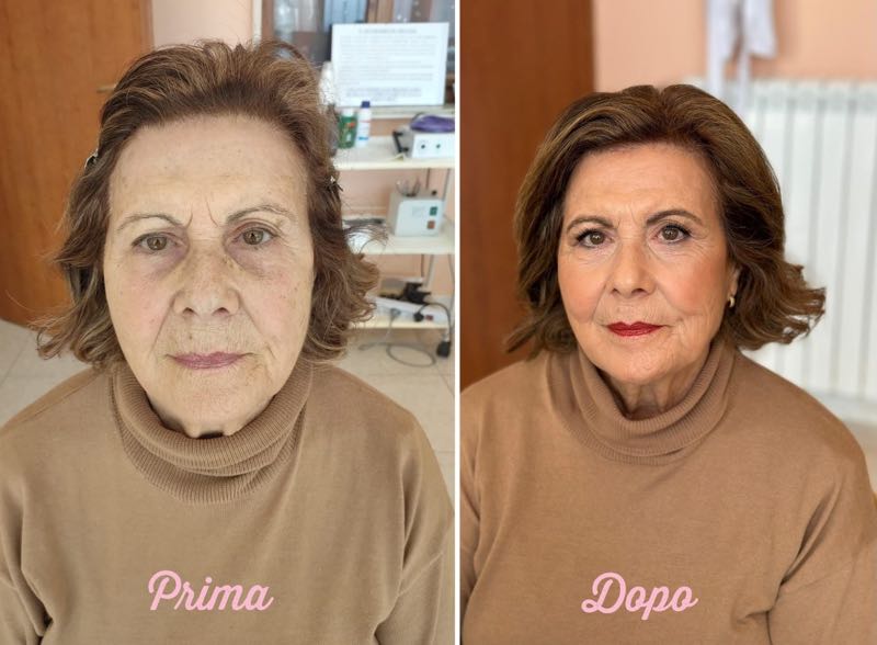 gall anti age